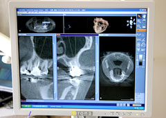 歯科用ＣＴスキャン