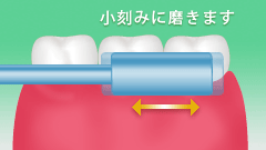 歯磨き指導・仕上げ磨きの指導